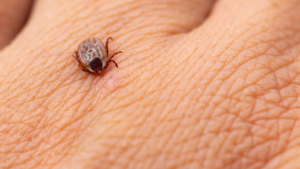 Kleszcz na ciele